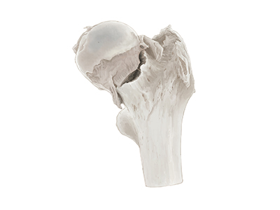 Upper limb and lower limb pathology